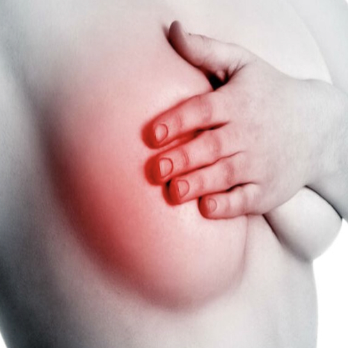 Tumores benignos y malignos de mama