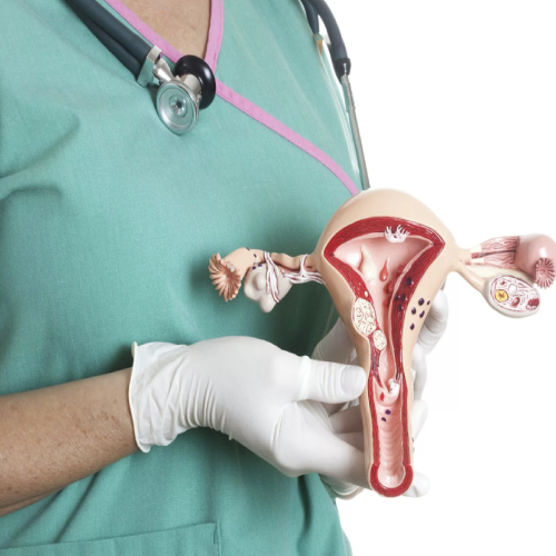 Tumores Ginecológicos